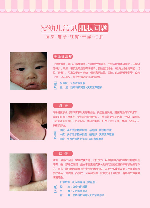 家庭御醫(yī)天然紫草原液詳情圖4.jpg